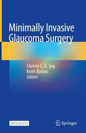 Barton / Sng |  Minimally Invasive Glaucoma Surgery | Buch |  Sack Fachmedien