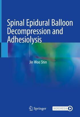 Shin |  Spinal Epidural Balloon Decompression and Adhesiolysis | Buch |  Sack Fachmedien