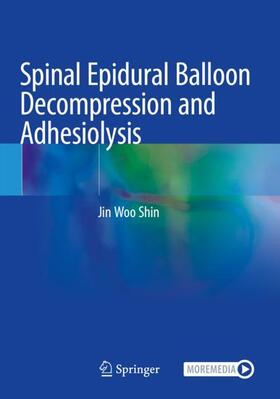 Shin |  Spinal Epidural Balloon Decompression and Adhesiolysis | Buch |  Sack Fachmedien