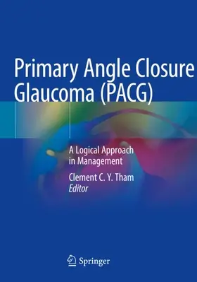 Tham |  Primary Angle Closure Glaucoma (PACG) | Buch |  Sack Fachmedien