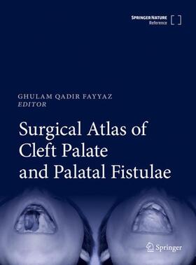 Fayyaz |  Surgical Atlas of Cleft Palate and Palatal Fistulae | Buch |  Sack Fachmedien