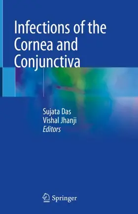 Jhanji / Das |  Infections of the Cornea and Conjunctiva | Buch |  Sack Fachmedien