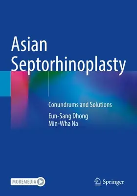 Na / Dhong |  Asian Septorhinoplasty | Buch |  Sack Fachmedien