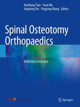 Tian / Wang / Ma |  Spinal Osteotomy Orthopaedics | Buch |  Sack Fachmedien