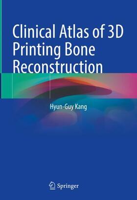Kang |  Clinical Atlas of 3D Printing Bone Reconstruction | Buch |  Sack Fachmedien