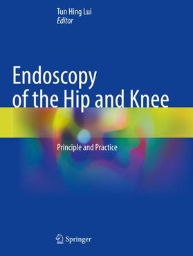 Lui |  Endoscopy of the Hip and Knee | Buch |  Sack Fachmedien