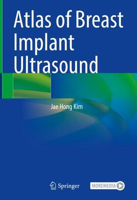 Kim |  Atlas of Breast Implant Ultrasound | Buch |  Sack Fachmedien