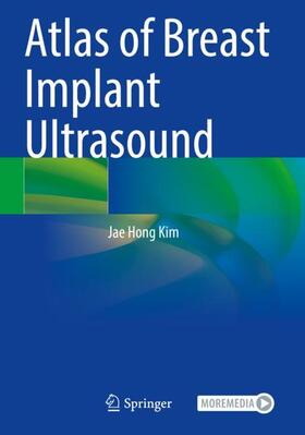 Kim |  Atlas of Breast Implant Ultrasound | Buch |  Sack Fachmedien