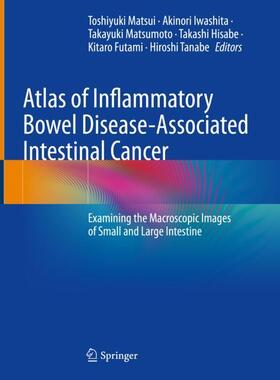 Matsui / Iwashita / Tanabe |  Atlas of Inflammatory Bowel Disease-Associated Intestinal Cancer | Buch |  Sack Fachmedien