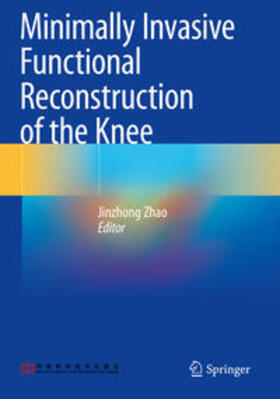 Zhao |  Minimally Invasive Functional Reconstruction of the Knee | Buch |  Sack Fachmedien