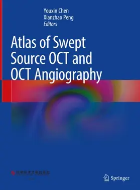 Peng / Chen |  Atlas of Swept Source OCT and OCT Angiography | Buch |  Sack Fachmedien