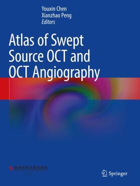 Chen / Peng |  Atlas of Swept Source OCT and OCT Angiography | Buch |  Sack Fachmedien