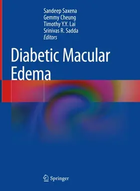 Saxena / Sadda / Cheung |  Diabetic Macular Edema | Buch |  Sack Fachmedien