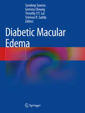 Saxena / Sadda / Cheung |  Diabetic Macular Edema | Buch |  Sack Fachmedien