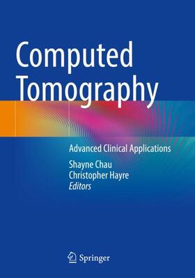 Hayre / Chau |  Computed Tomography | Buch |  Sack Fachmedien