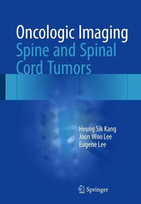 Kang / Lee |  Oncologic Imaging: Spine and Spinal Cord Tumors | Buch |  Sack Fachmedien