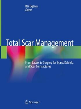Ogawa |  Total Scar Management | Buch |  Sack Fachmedien