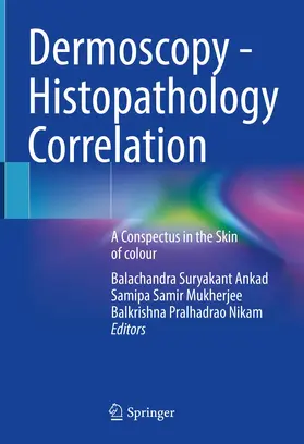 Ankad / Nikam / Mukherjee |  Dermoscopy - Histopathology Correlation | Buch |  Sack Fachmedien