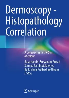 Ankad / Nikam / Mukherjee |  Dermoscopy - Histopathology Correlation | Buch |  Sack Fachmedien