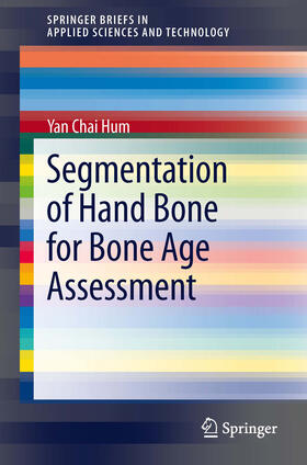 Hum |  Segmentation of Hand Bone for Bone Age Assessment | eBook | Sack Fachmedien