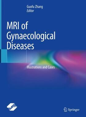 Zhang |  MRI of Gynaecological Diseases | Buch |  Sack Fachmedien