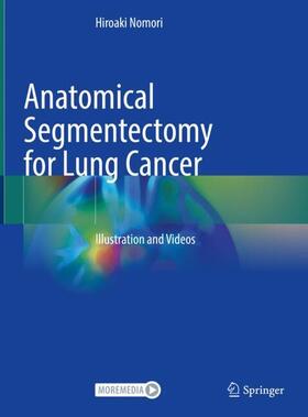 Nomori |  Anatomical Segmentectomy for Lung Cancer | Buch |  Sack Fachmedien