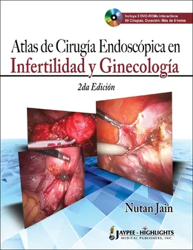 Jain |  Atlas de Cirugia Endoscopica en Infertilidad y Ginecologica 2/E | Buch |  Sack Fachmedien