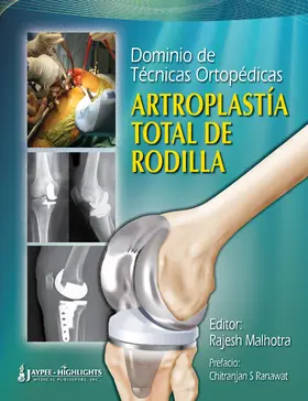 Malhotra |  Dominio de Tecnicas Ortopedicas: Artroplastia Total de Rodilla | Buch |  Sack Fachmedien