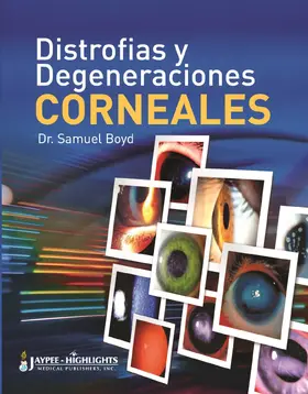 Boyd |  Distrofías y Degeneraciones Corneales | Buch |  Sack Fachmedien