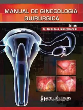 Mastellari M |  Manual de Ginecologia Quirurgica | Buch |  Sack Fachmedien